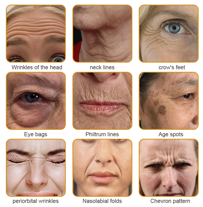 Made and Shipped from UK-Furzero⢠Botox Bee Venom Wrinkle Removal Cream-Last Day Promotion 70% OFF