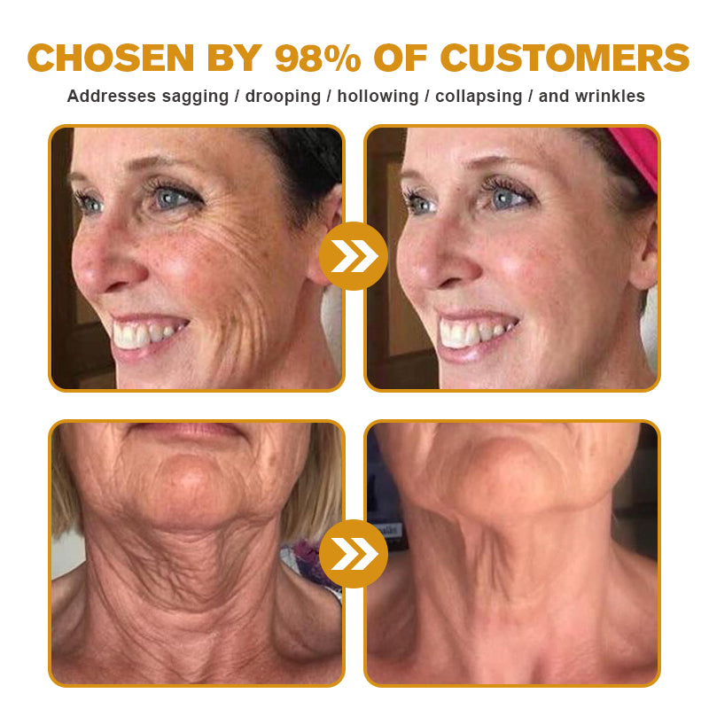 â¨đMHRA Approvedâ¨Furzero⢠Botox Bee Venom Wrinkle Removal Cream-Last Day Promotion 70% OFF