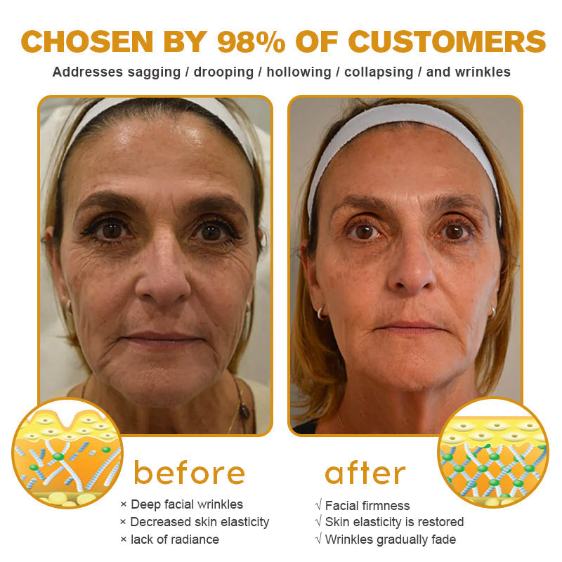 â¨đMHRA Approvedâ¨Furzero⢠Botox Bee Venom Wrinkle Removal Cream-Last Day Promotion 70% OFF